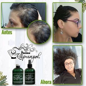 Pócima de Rapunzel (RAPUNZEL´S POTION)